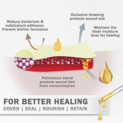 EVERLIT Xeroform Petrolatum Dressing | Sterile, Non-Adherent Occlusive Fine Mesh Gauze Pad | Non-Toxic, Gentle Patch for Burns, Laceration, Surgical Incisions & Skin Grafts (4" x 4" | Pack of 25) - size: 4" x 4" | Pack of 25