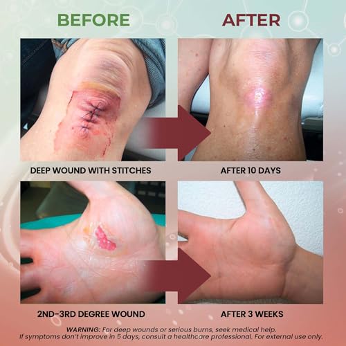 MediQuick Wound Care Hydrogel Drops - First Aid Drops with 12 Hours Action - size: Hydrogel Drops (4 Ounce)